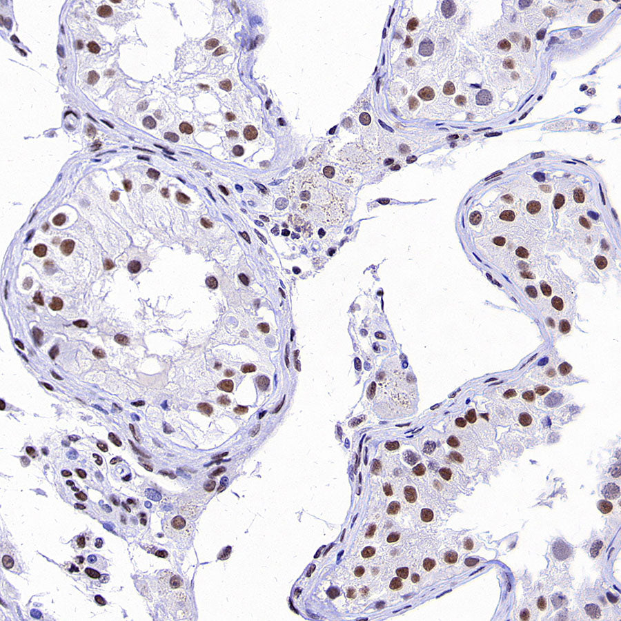 Brd4 Recombinant Rabbit mAb (S-5145)