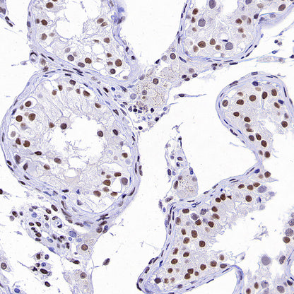 Brd4 Recombinant Rabbit mAb (S-5145)
