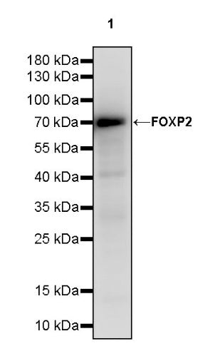 FOXP2 Recombinant Rabbit mAb (S-2342-8)