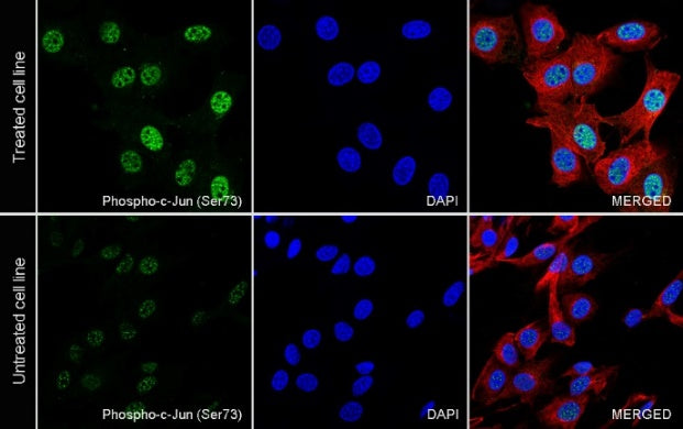 Phospho-c-Jun (Ser73) Recombinant Rabbit mAb (S-3105-71)