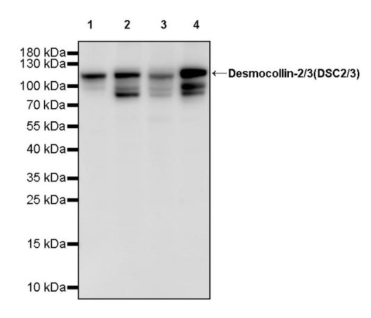 Desmocollin-2/3(DSC2/3) Recombinant Rabbit mAb (SDT-2102-59)
