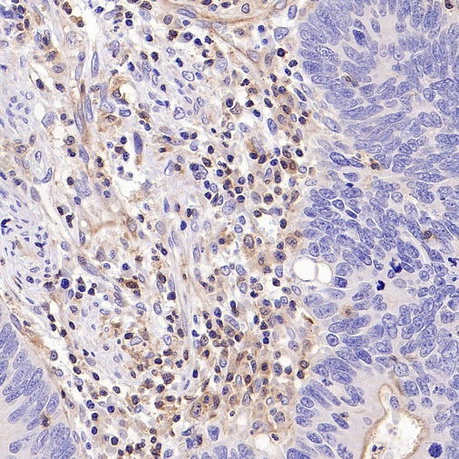 IRF-5 Recombinant Rabbit mAb (S-3056-28)