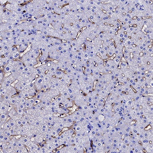 Angiotensin Converting Enzyme 1 Recombinant Rabbit mAb (SDT-2662-122)
