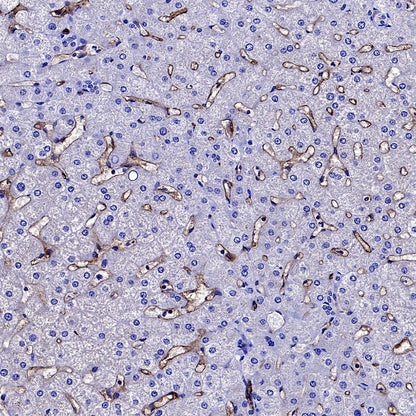 Angiotensin Converting Enzyme 1 Recombinant Rabbit mAb (SDT-2662-122)
