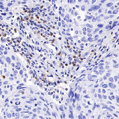 CD6 Recombinant Rabbit mAb (S-1512-39)