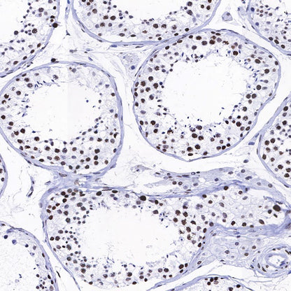 Histone H3 (acetyl K9) Rabbit polyclonal antibody
