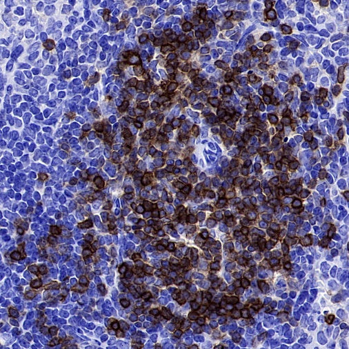 CD5 Recombinant Rabbit mAb (SDT-2857-16)