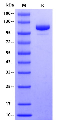 E. coli LacZ Protein, His tag
