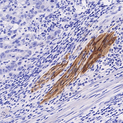 LICAM Recombinant Rabbit mAb (SDT-2594-39)