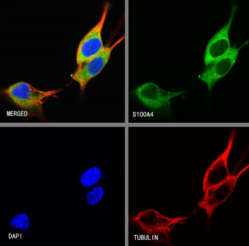 S100A4 Recombinant Rabbit mAb (S-1655-26)