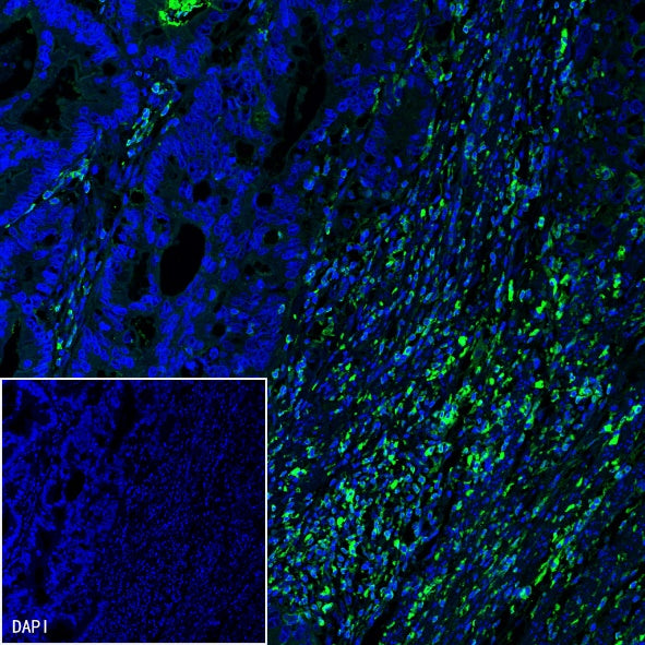 TIM-3 Recombinant Rabbit mAb (S-1450-21)