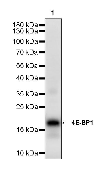4E-BP1 Recombinant Rabbit mAb (S-4103-65)