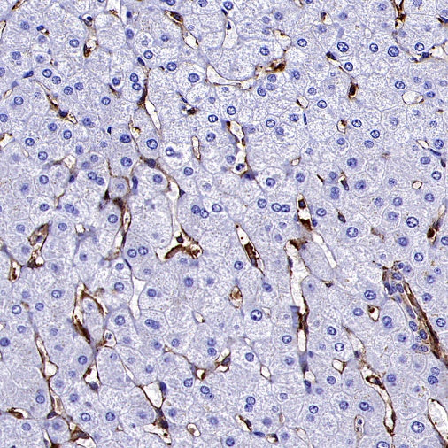 Transgelin 2 Recombinant Rabbit mAb (S-2809-73)