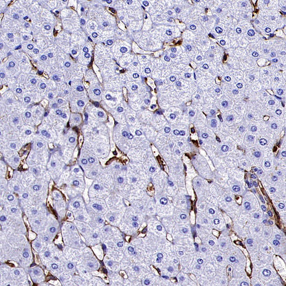 Transgelin 2 Recombinant Rabbit mAb (S-2809-73)
