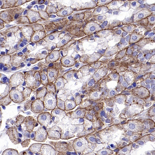ATP7A Recombinant Rabbit mAb (S-2289-106)
