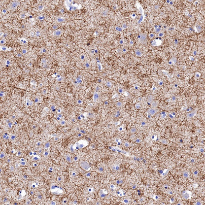Caspr Recombinant Rabbit mAb (S-1706-1)