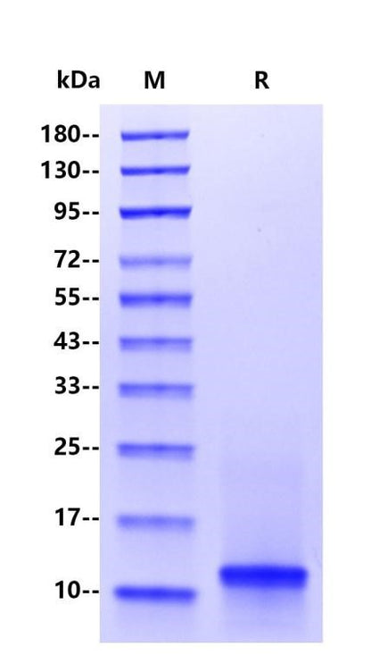 IL-8 His Tag Protein, Human