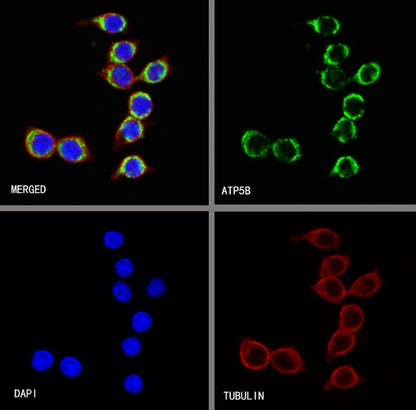 ATP5B Recombinant Rabbit mAb (S-1271-29)