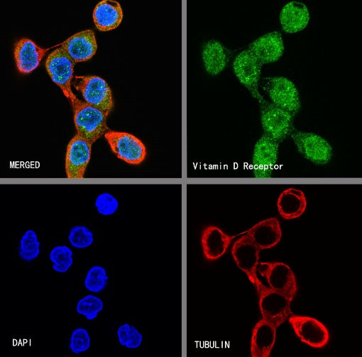 Vitamin D Receptor Recombinant Rabbit mAb (S-1719-7)