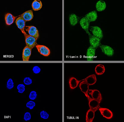 Vitamin D Receptor Recombinant Rabbit mAb (S-1719-7)