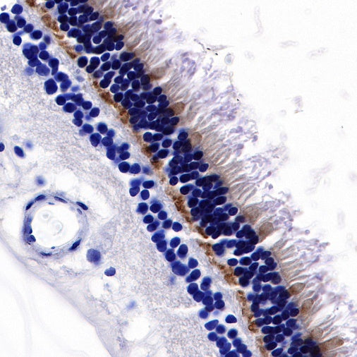 PSD-95 Recombinant Rabbit mAb (S-R311)