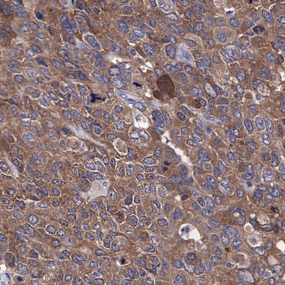 STIP1 Recombinant Rabbit mAb (S-680-39)
