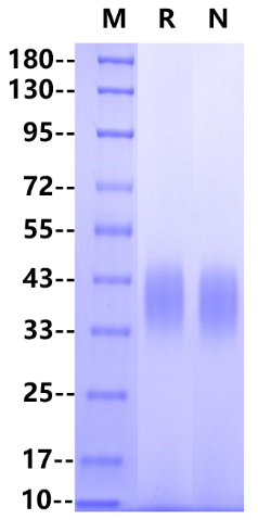 Fc γ RIIB/CD32b His Tag Protein, Mouse