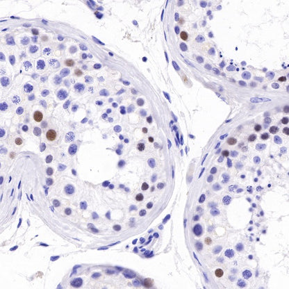 SAGE1 Recombinant Rabbit mAb (SDT-317-60)