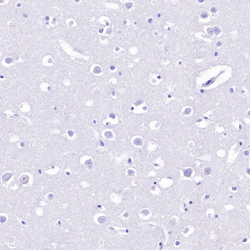 Villin Recombinant Rabbit mAb (SDT-R255)