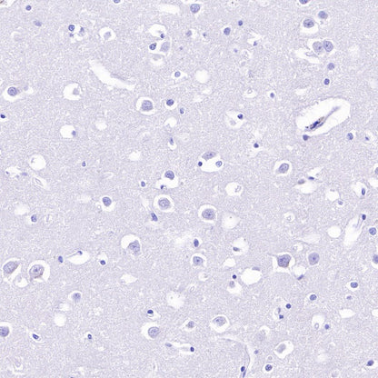 Villin Recombinant Rabbit mAb (SDT-R255)