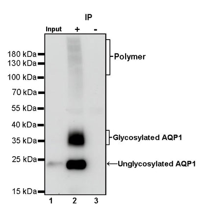 Aquaporin 1/AQP1 Recombinant Rabbit mAb (S-794-79)
