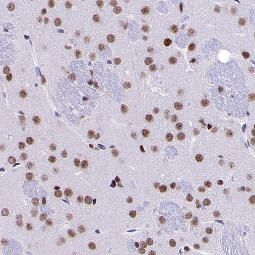METTL3 Recombinant Rabbit mAb (S-315-219)