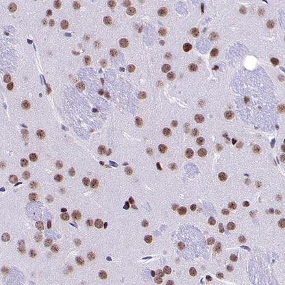 METTL3 Recombinant Rabbit mAb (S-315-219)