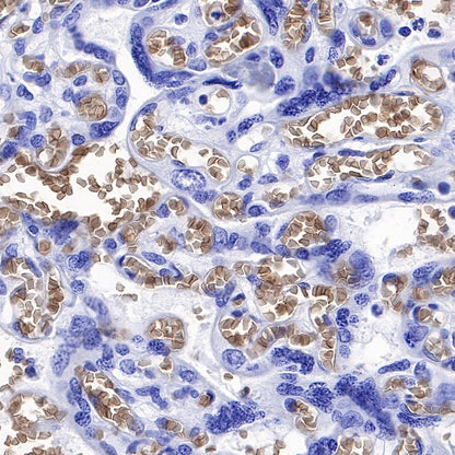 Aquaporin 1/AQP1 Recombinant Rabbit mAb (S-794-79)