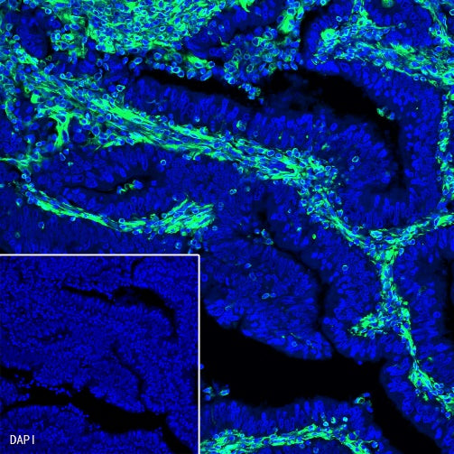 Vimentin Recombinant Rabbit mAb (Alexa Fluor® 488 Conjugate) (S-029-20)