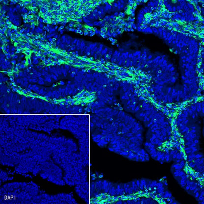 Vimentin Recombinant Rabbit mAb (Alexa Fluor® 488 Conjugate) (S-029-20)