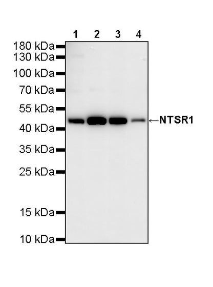NTSR1 Recombinant Rabbit mAb (S-4844-38)