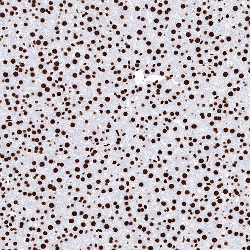 Histone H3 (mono methyl K36) Recombinant Rabbit mAb (S-R396)