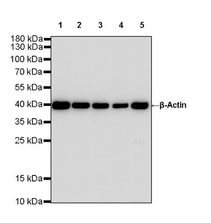 β-Actin Recombinant Rabbit mAb (S-5701)