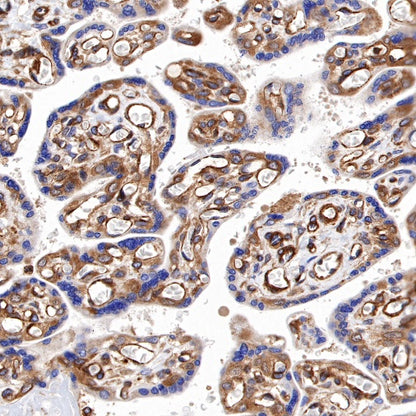 Paxillin Recombinant Rabbit mAb (S-619-12)
