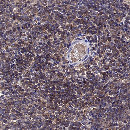 PPIA Recombinant Rabbit mAb (S-2406-28)