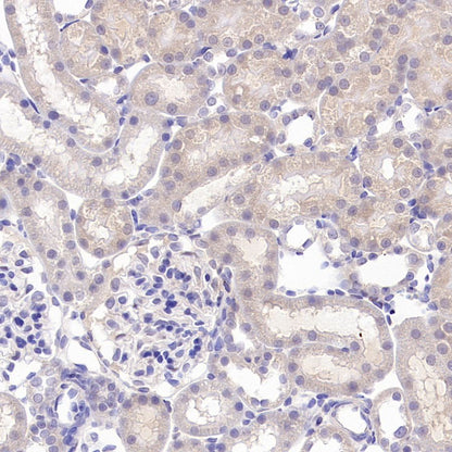 TYK2 Recombinant Rabbit mAb (S-2740-165)