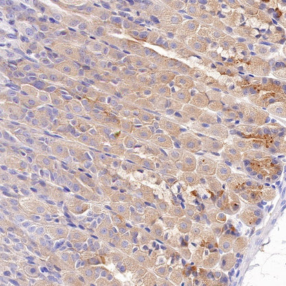 Tuberin/TSC2 Recombinant Rabbit mAb (S-1138-125)