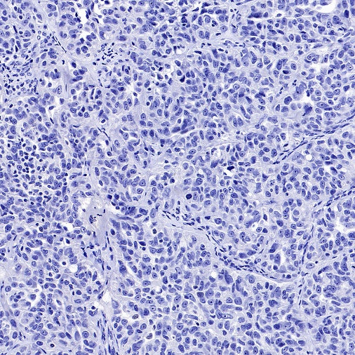 GRM5 Recombinant Rabbit mAb (SDT-2419-37)
