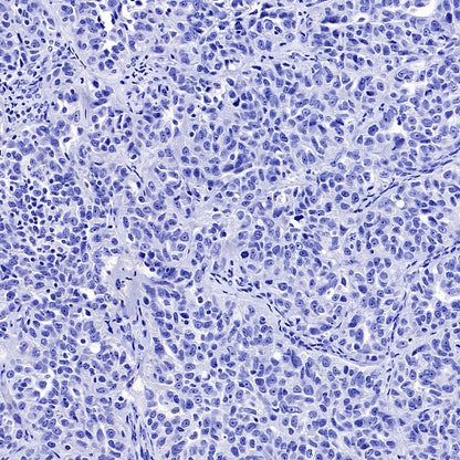 GRM5 Recombinant Rabbit mAb (SDT-2419-37)