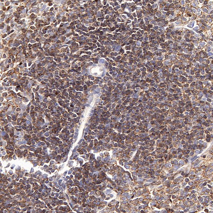 Moesin Rabbit Polyclonal Antibody