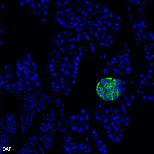 Somatostatin Receptor 2 Recombinant Rabbit mAb (SDT-2507-1)