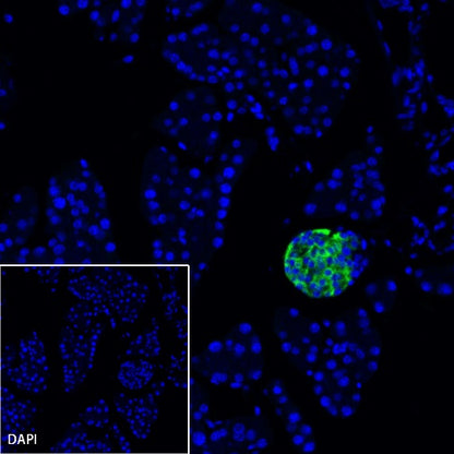 Somatostatin Receptor 2 Recombinant Rabbit mAb (SDT-2507-1)