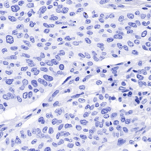 CA125 Recombinant Rabbit mAb (SDT-555-41)