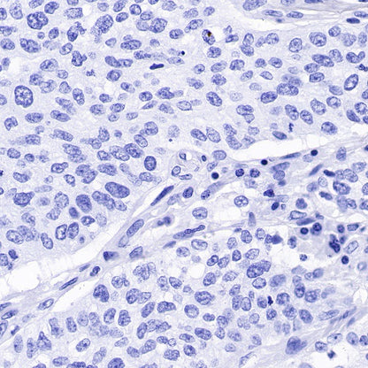 CA125 Recombinant Rabbit mAb (SDT-555-41)